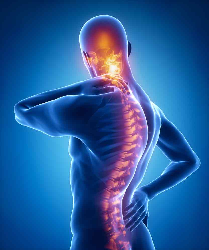 Facet joint release technique: Complete guide neck back pain oakland physical therapy SOL 409424113 1 facet joint release technique