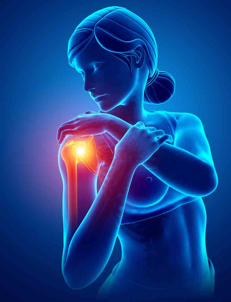 Understanding Shoulder Impingement Syndrome shoulder pain oakland physical therapy 598778627 1 understanding shoulder impingement syndrome health and wellness