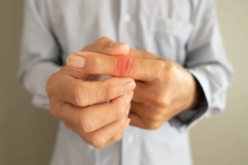 physical therapy for trigger finger hand pain